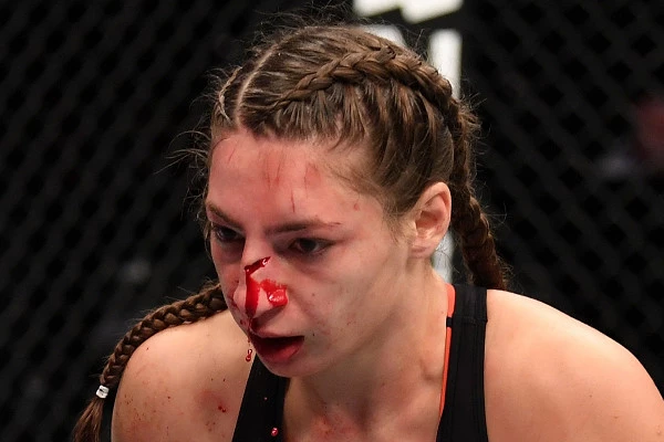 Российская боец UFC получила страшное рассечение